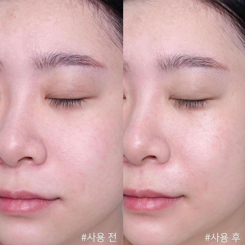 Centella Asiatica Zaman Geri G - Skincare Centella incelemesi ve fiyatı