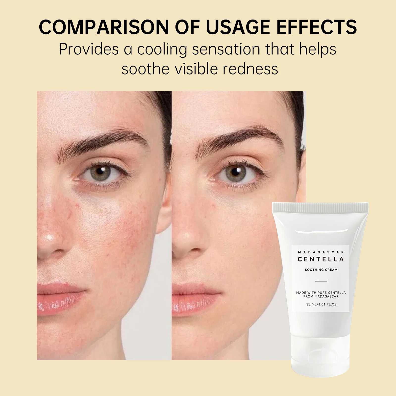 Centella Asiatica Yatıştırıcı  - Skincare Centella incelemesi ve fiyatı