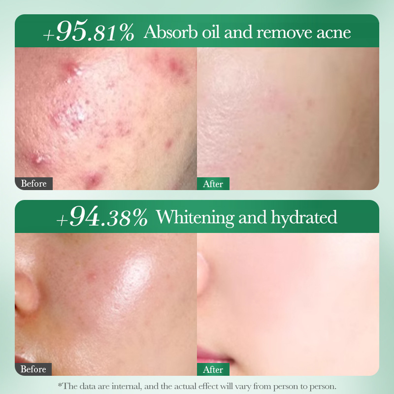Salisilik Asit Beyazlatıcı ve  - Salicylic Acid Cleanser incelemesi ve fiyatı