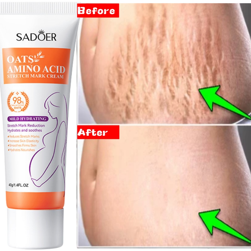 Çatlakları Kalıcı Olarak Gider - Skincare Oat incelemesi ve fiyatı