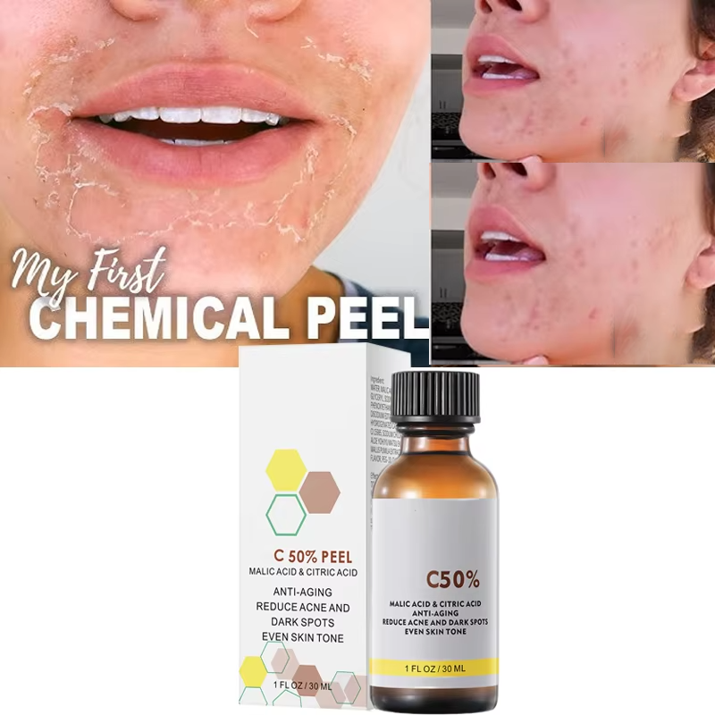 Yüz Yüz Peelingi İçin Malik As - Salicylic Acid Cleanser incelemesi ve fiyatı